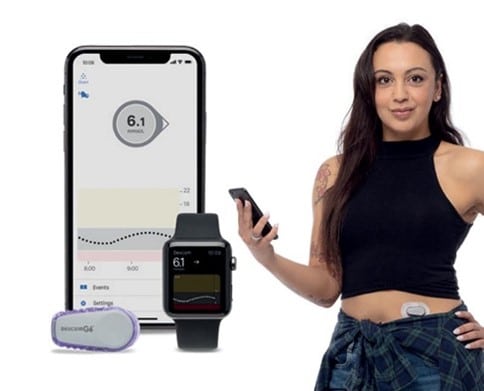 La solution Dexcom