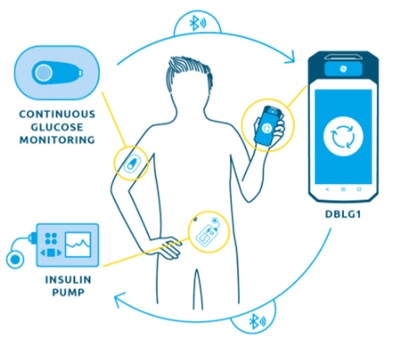Solution Diabeloop pour automatiser le traitement du diabète de type 1